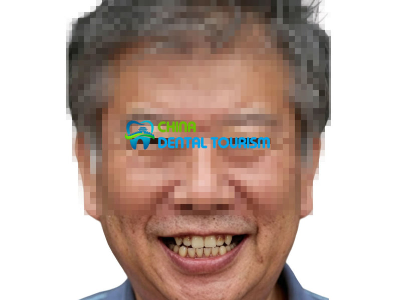 Smile